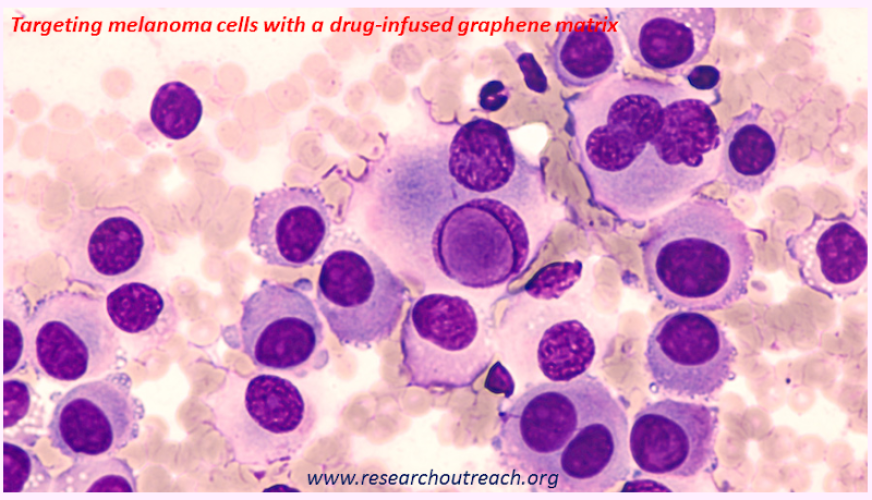 Targeting melanoma cells with a drug-infused graphene matrix